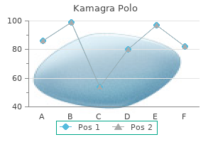 cheap 100 mg kamagra polo mastercard