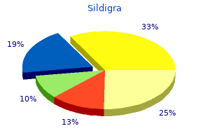 order sildigra with amex