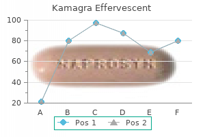 generic 100 mg kamagra effervescent overnight delivery