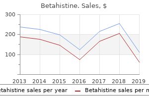 purchase betahistine 16mg on-line
